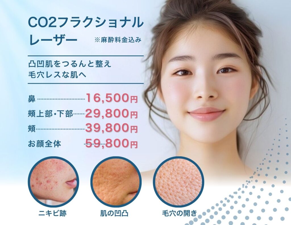 CO2フラクショナルレーザー