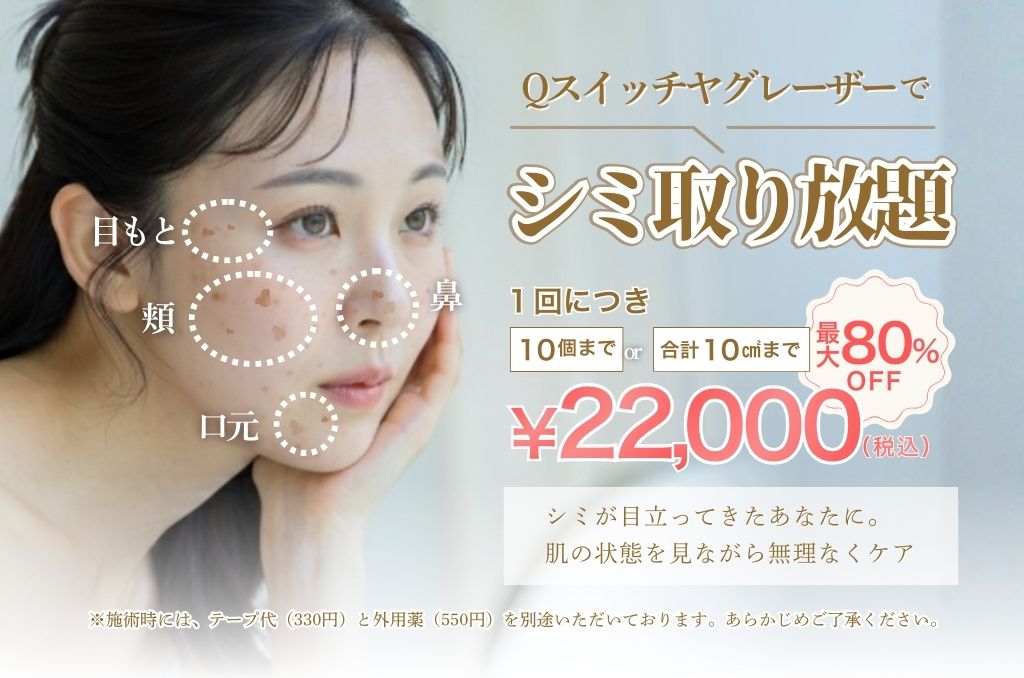 【冬キャンペーン】シミ取り放題22,000円【最大80%OFF】