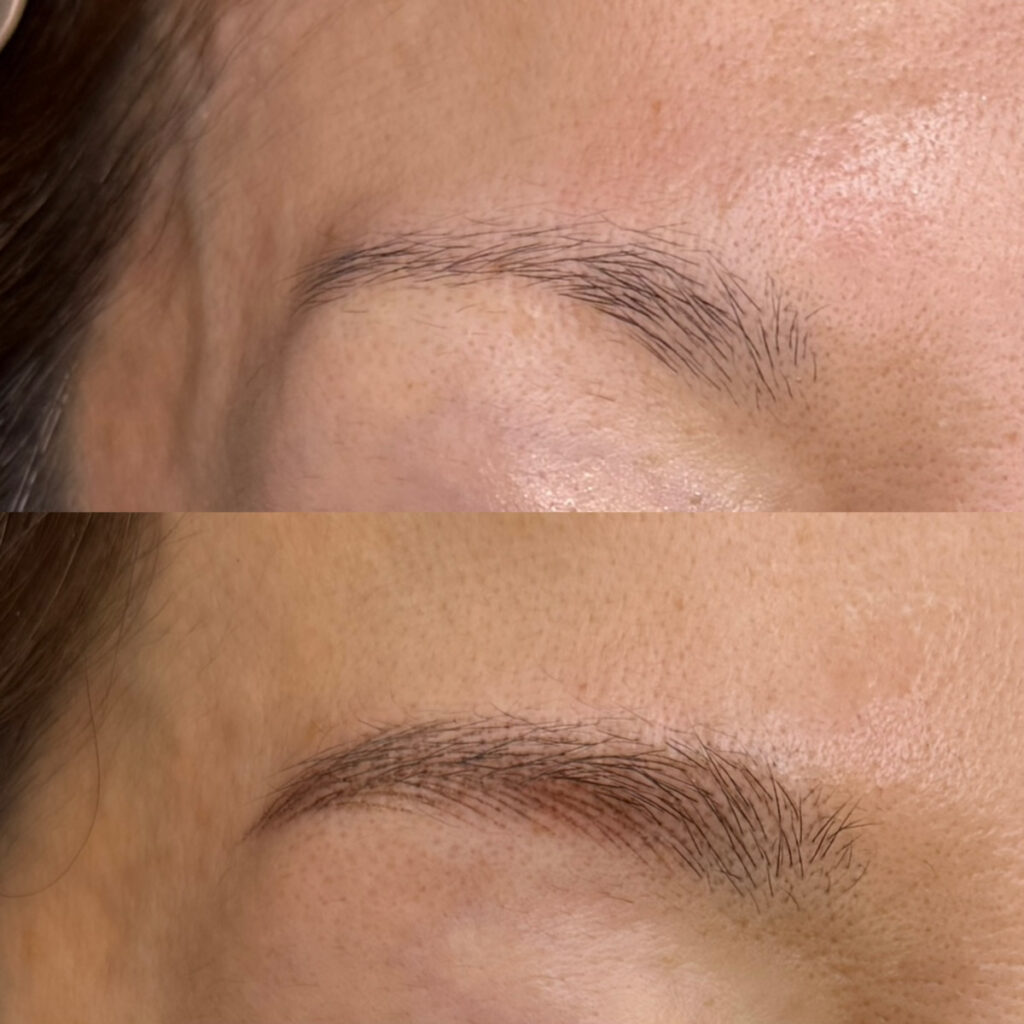 眉アートメイク(マシンヘアストローク)症例写真2